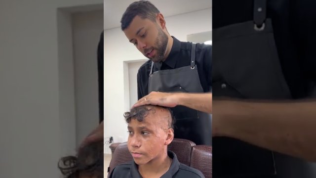 Mężczyzna pomógł młodemu chłopakowi, który stracił włosy podczas pożaru [WIDEO]