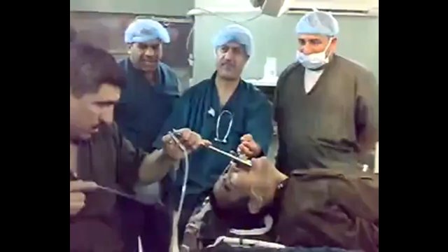 Chirurdzy wyciągają zardzewiały klucz z gardła mężczyzny w Indiach… a potem się z tego śmieją