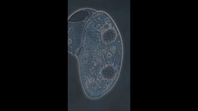 Tak wygląda umierająca komórka