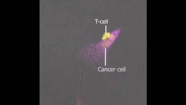 Badacze odkryli wyjątkowe limfocyty T, które niszczą raka [WIDEO]