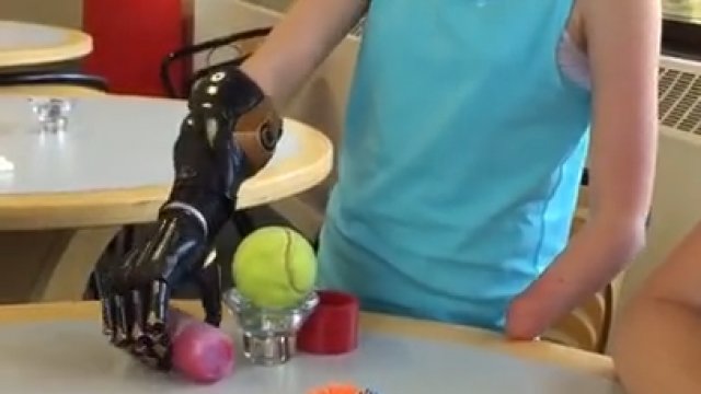 Dziewczynka po raz pierwszy używa bionicznej ręki.