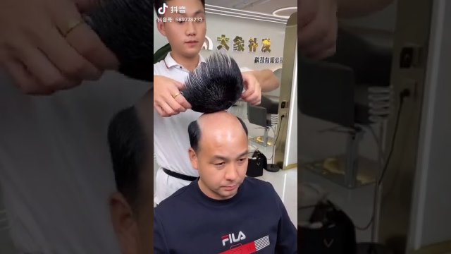 Azjatycki sposób na łysinkę