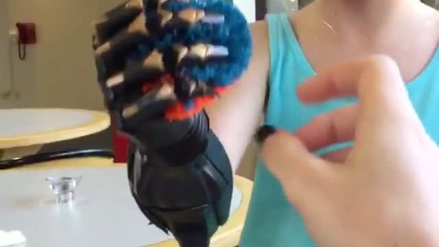 Bioniczna ręka - to dzieje się naprawdę